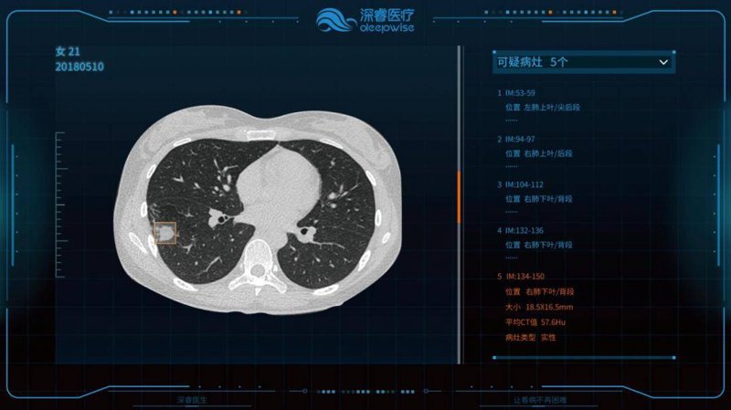 智能辅助诊断系统:医疗行业的未来风向标